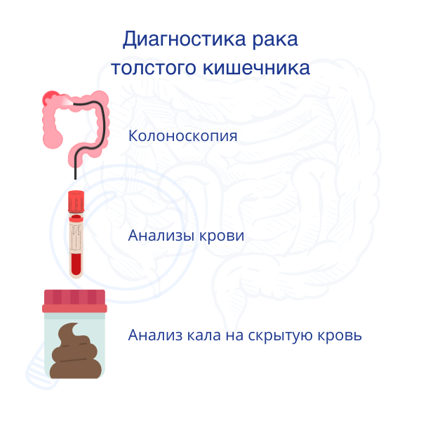 Диагностика рака толстого кишечника